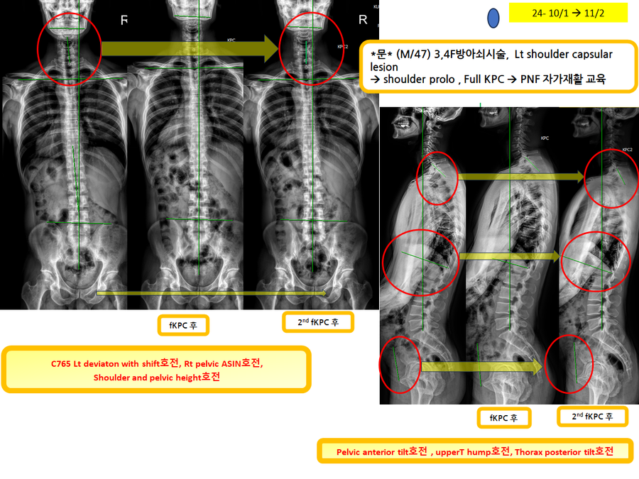 a5ea361becdce3b65a540bd6b2491ff9_1730674207_7813.png