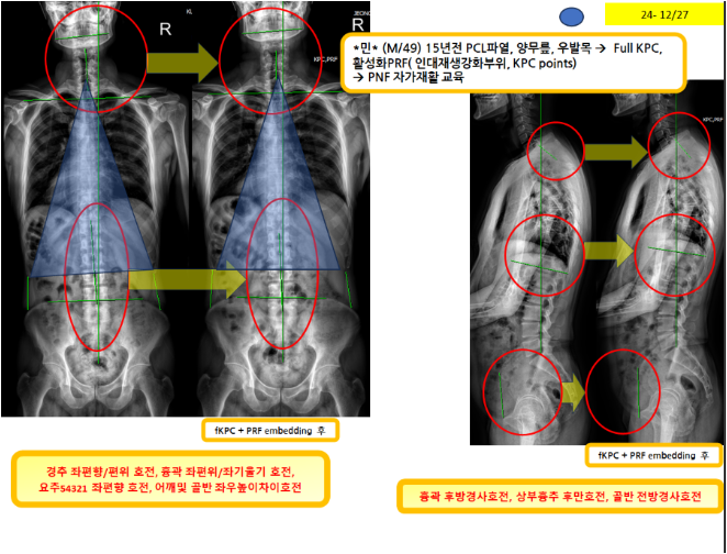 e8594d75d60f4b1d351f12f1183079de_1735525200_0555.png