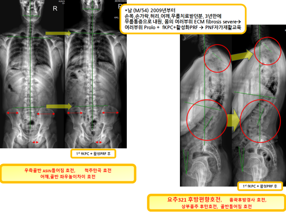 aa784ea17edc863366b2154e6cd7d870_1739839944_8544.png aa784ea17edc863366b2154e6cd7d870_1739839944_8544.png
