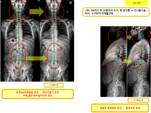 44abe95f7f7a807ba90e4807a853da67_1752151829_046.png