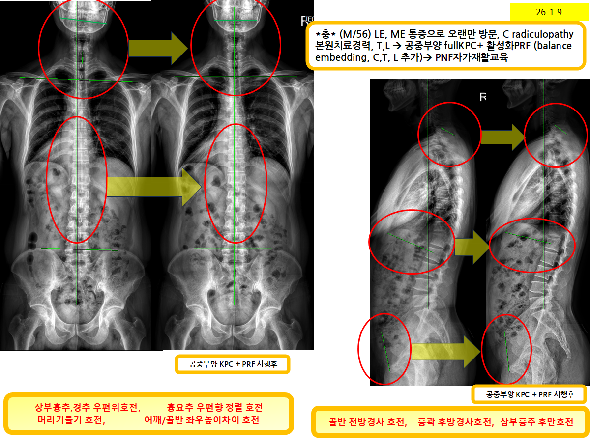 06a86448dece4313be6e31995a40aa33_1768608211_9768.png