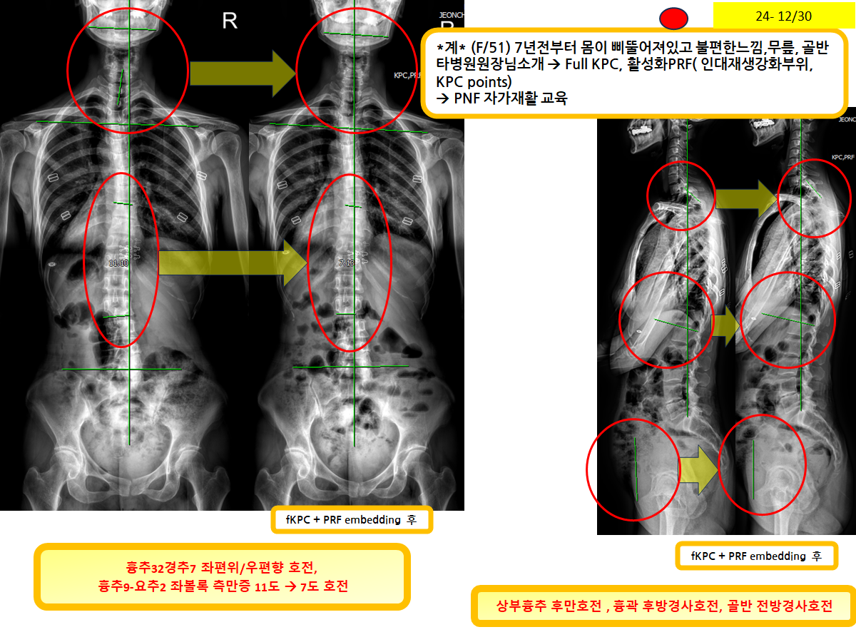 0ebd84477f293077f78d7a0cb2e630ed_1772167750_3399.png