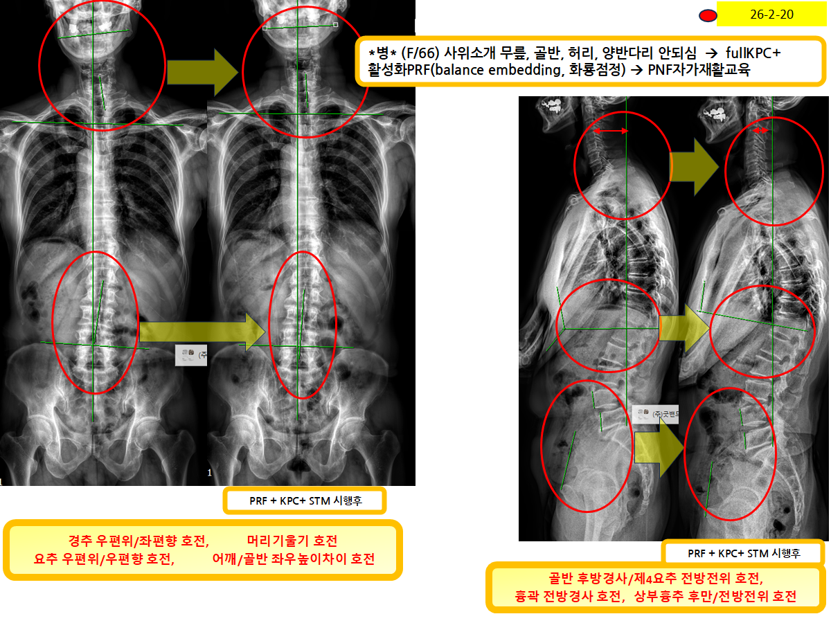 3bdbce2007bcd12fb5a566a9fd0a5e70_1771911633_9938.png 3bdbce2007bcd12fb5a566a9fd0a5e70_1771911633_9938.png