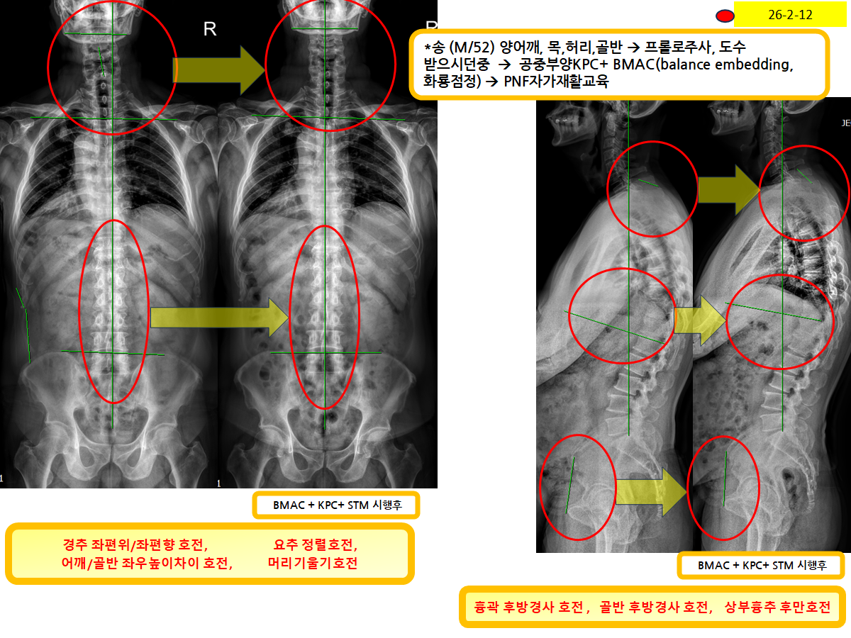 ad181e306bd62a6cfb4208abbe58130d_1771040596_9812.png