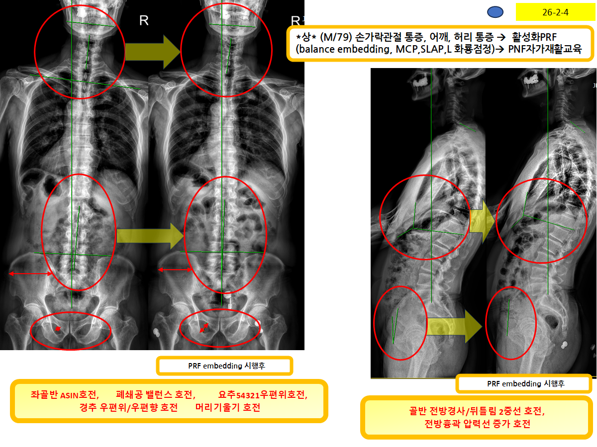 b4561ee6c991c2a9255e1760bf057e2d_1770260094_9202.png