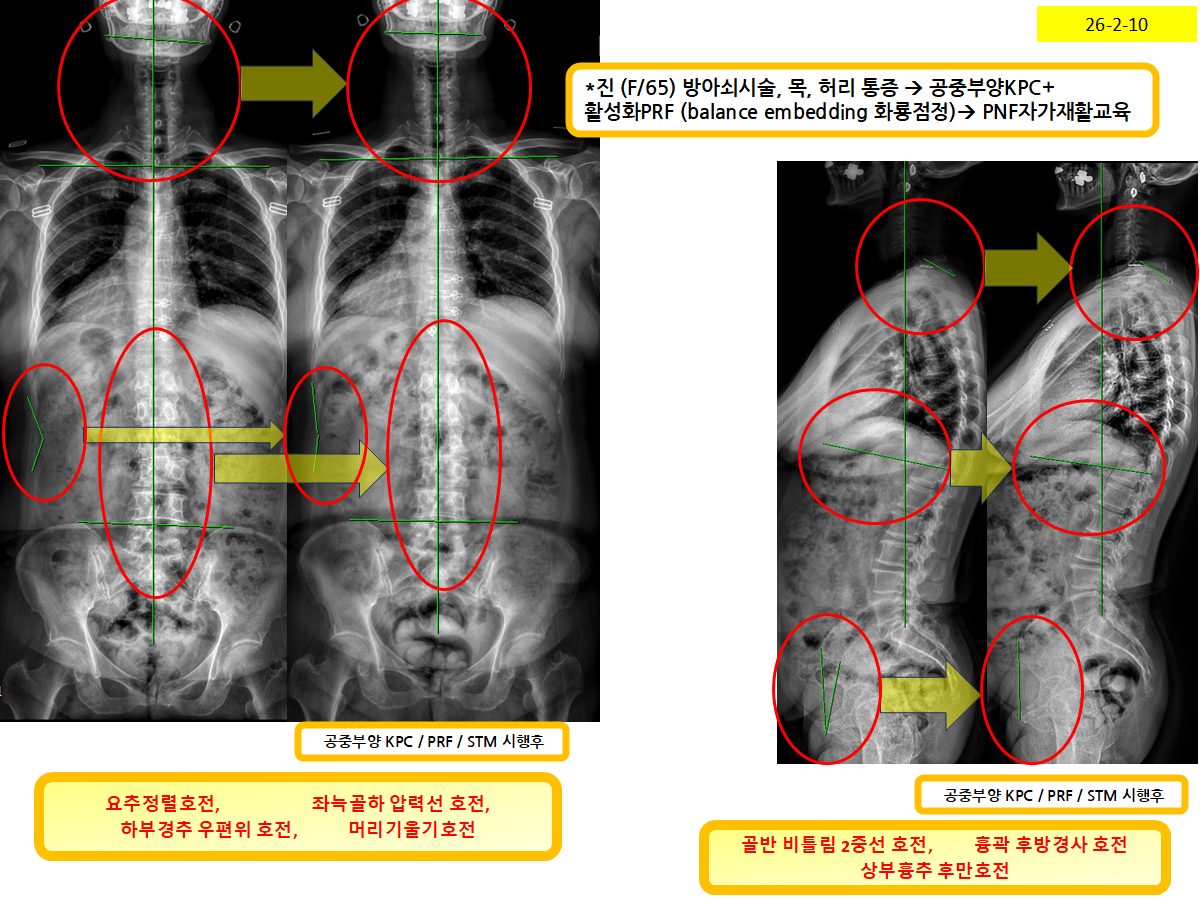 fdcb4f723959aaba70ee17557e34a3c1_1770767481_4.png fdcb4f723959aaba70ee17557e34a3c1_1770767481_4.png