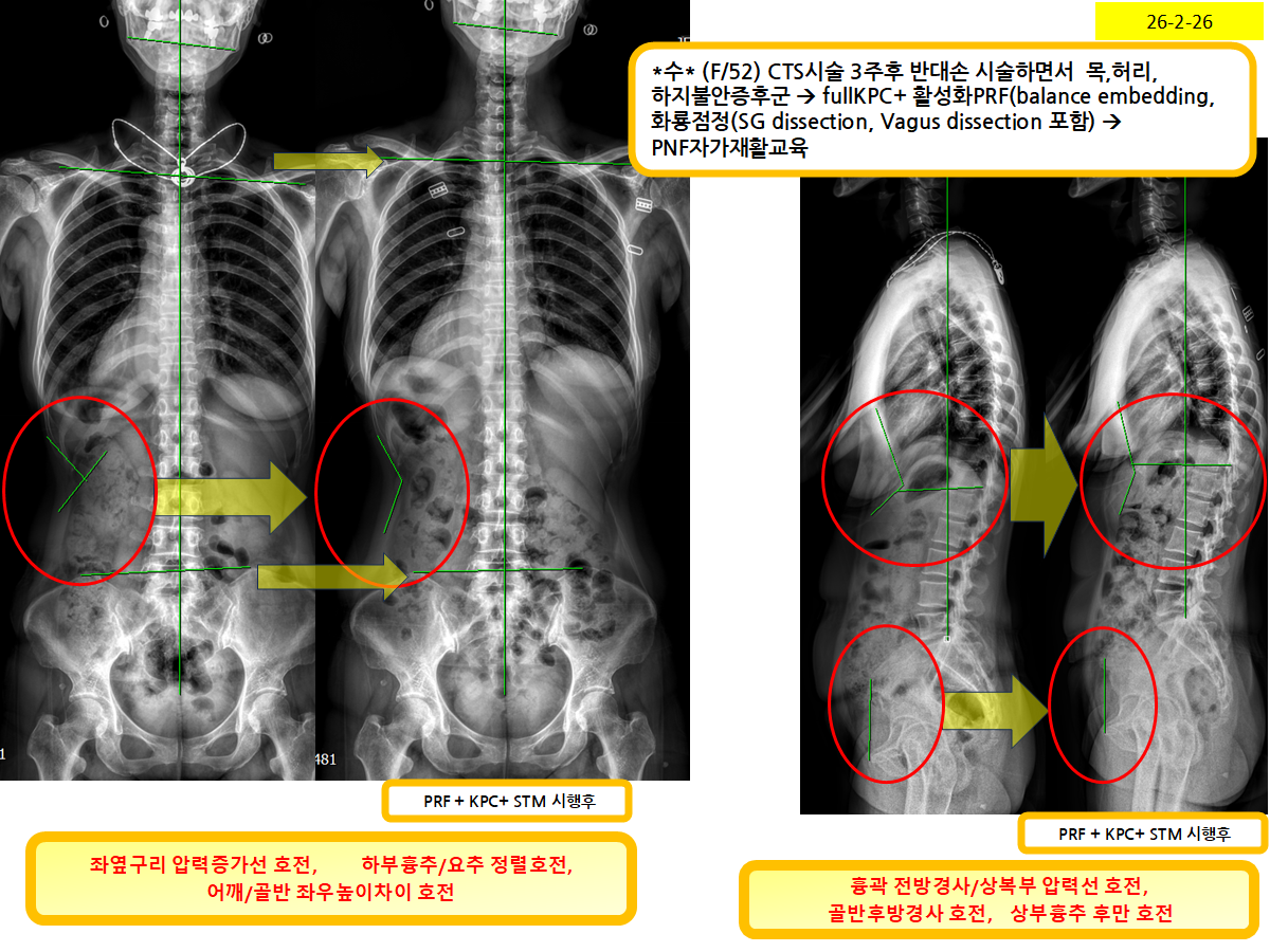 fffb4d955ad27c2e63f5da7f5a5e645d_1772498278_8074.png