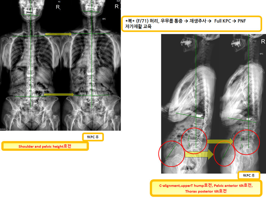 765abaa53a04bb600d16684182152298_1731052780_7585.png