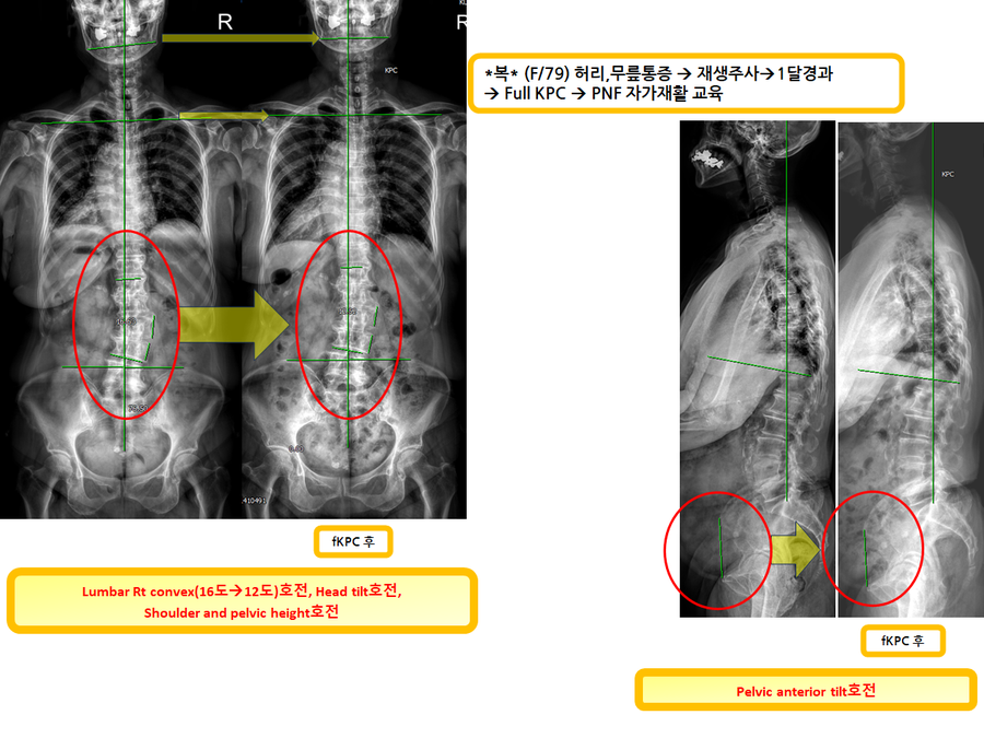 765abaa53a04bb600d16684182152298_1731052780_8924.png