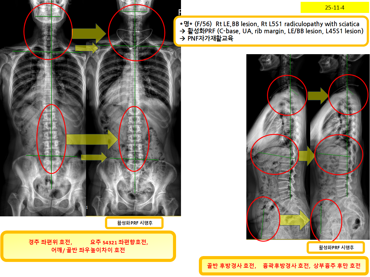 9391befa38c645cf578d90b477bccfcf_1762404340_0573.png