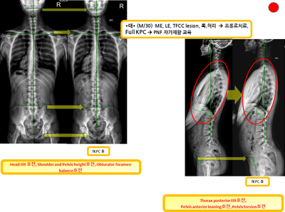 ac11a5eb25b829abedc1e98a9b9bba34_1723185414_376.png ac11a5eb25b829abedc1e98a9b9bba34_1723185414_376.png