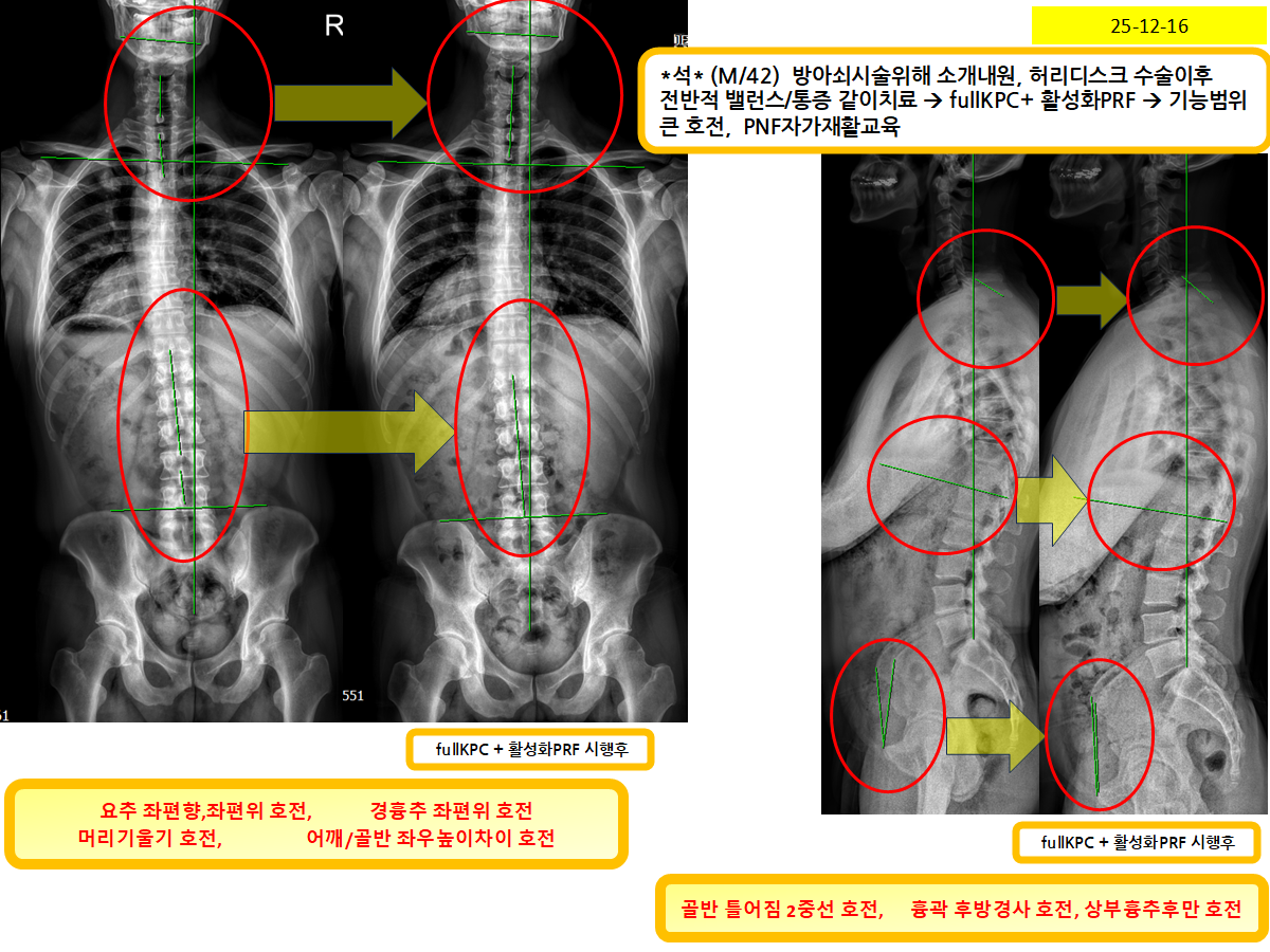 b48dedbc85ee1b291604e6d097f8ef0b_1766185434_3635.png b48dedbc85ee1b291604e6d097f8ef0b_1766185434_3635.png