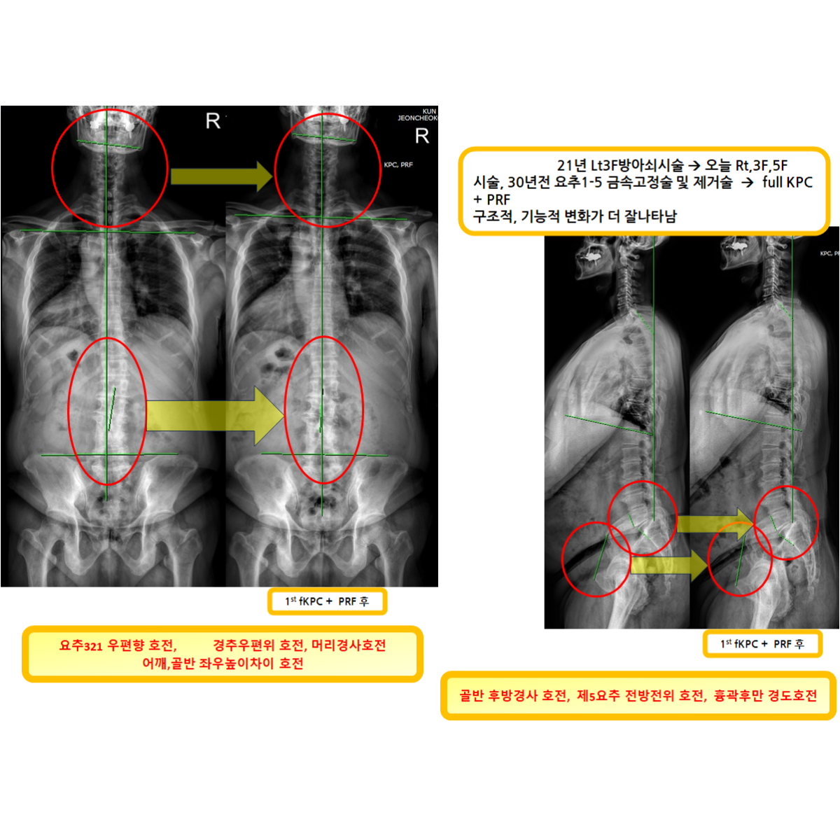 b673327bcc7361cb3f0c25364d6bcc41_1787112013_2002.png b673327bcc7361cb3f0c25364d6bcc41_1787112013_2002.png