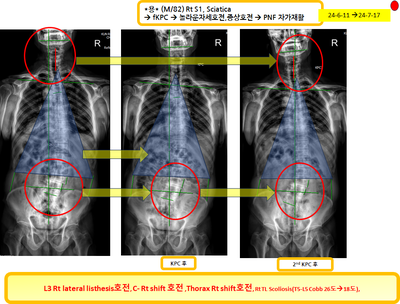 c533434e080316cc00d04b5c8ac197cd_1721349302_3355.png c533434e080316cc00d04b5c8ac197cd_1721349302_3355.png