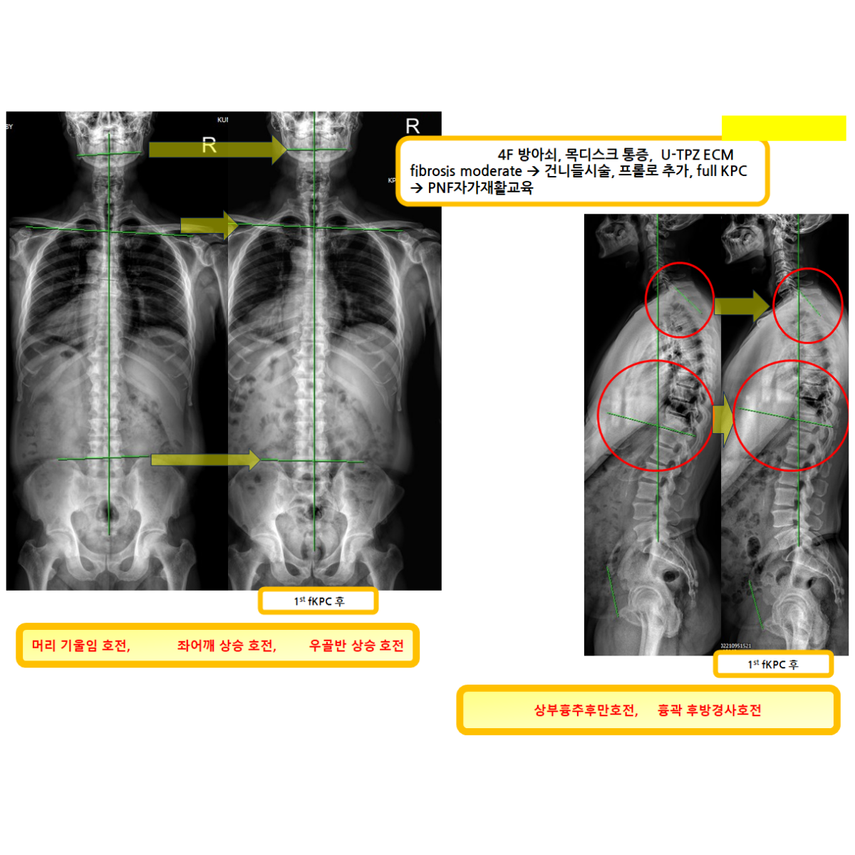 d9fa7482618a6f3667a0f10b56e24139_1787710230_8498.png