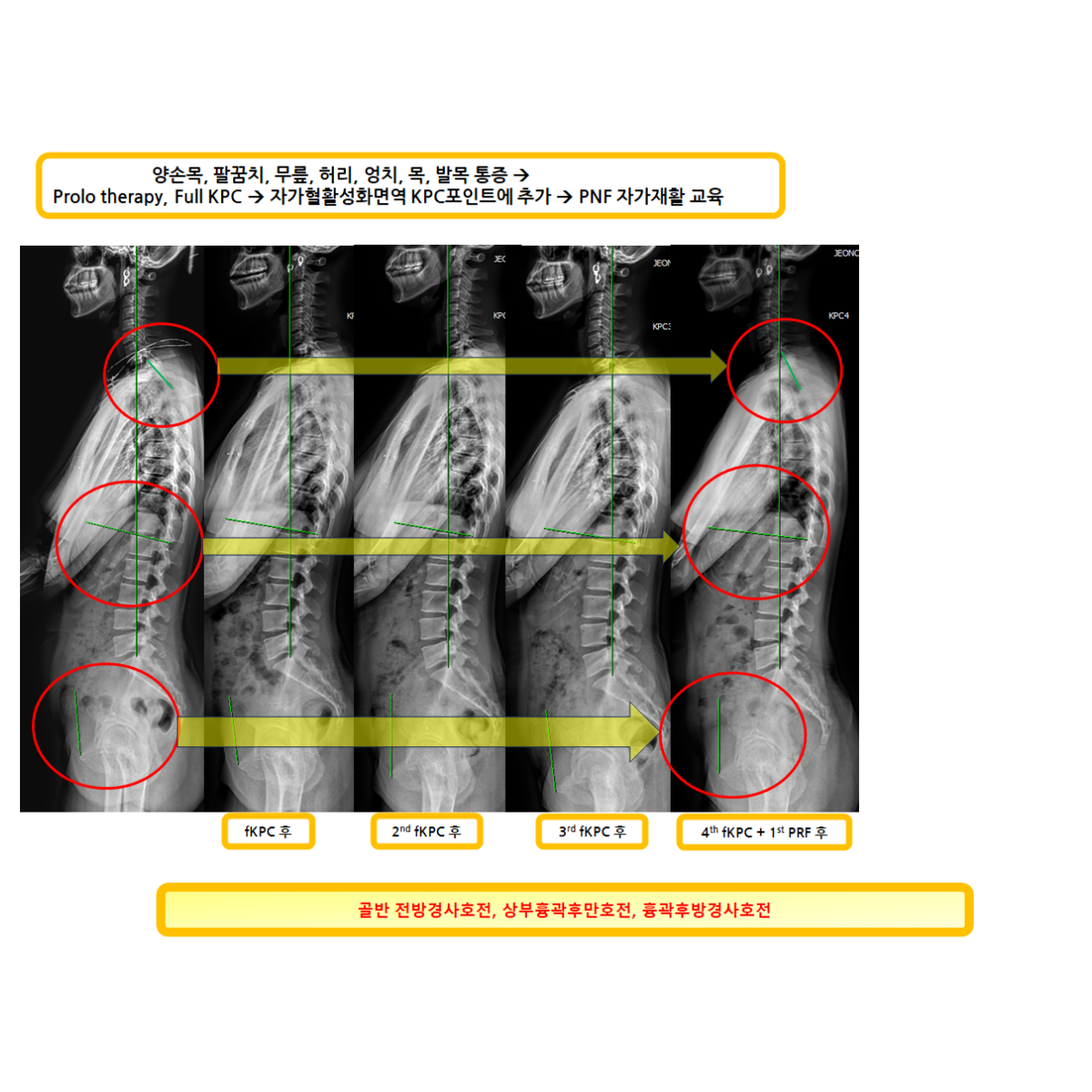dfe1ce1501e370b62e5f7c0c49fbe64d_1786503724_1433.png dfe1ce1501e370b62e5f7c0c49fbe64d_1786503724_1433.png