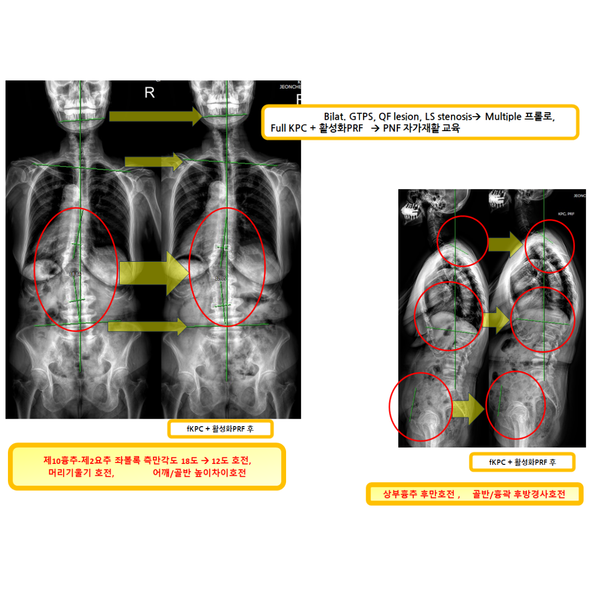 e3959cd3232b07a1454039068e8e5c0d_1787878174_4547.png e3959cd3232b07a1454039068e8e5c0d_1787878174_4547.png