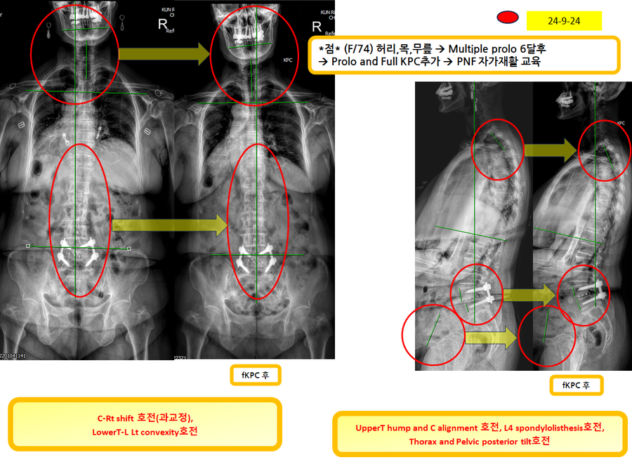 e7b8c93668ef34aab35ad13eb085cdf6_1727275796_7503.png e7b8c93668ef34aab35ad13eb085cdf6_1727275796_7503.png