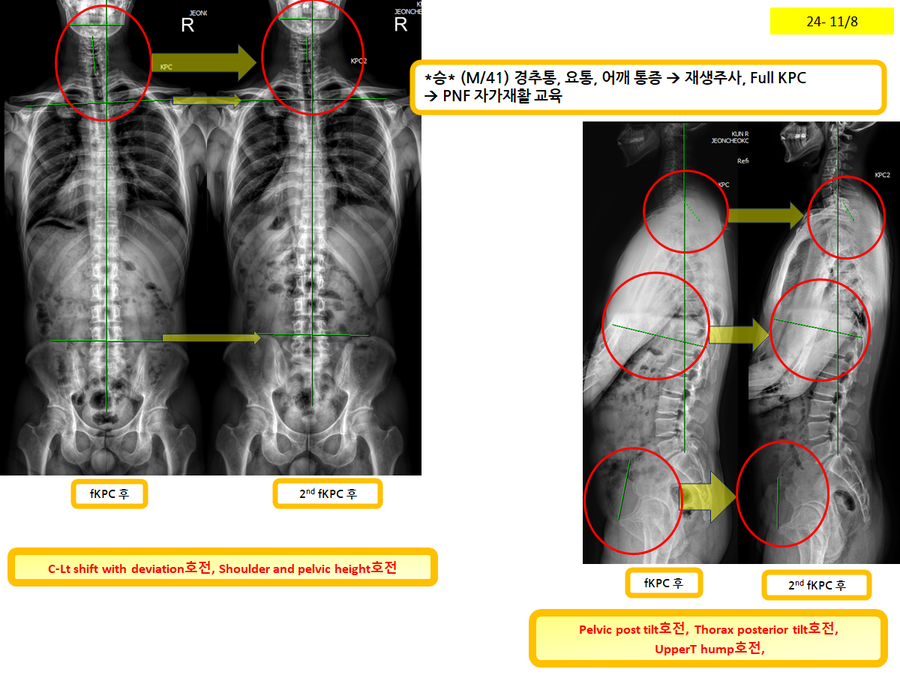 eb226a0319bd9fc6497f208093e77d5a_1731113213_5593.png