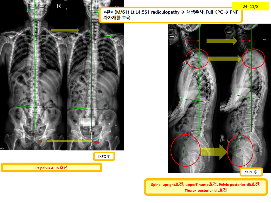 eb226a0319bd9fc6497f208093e77d5a_1731113213_6814.png