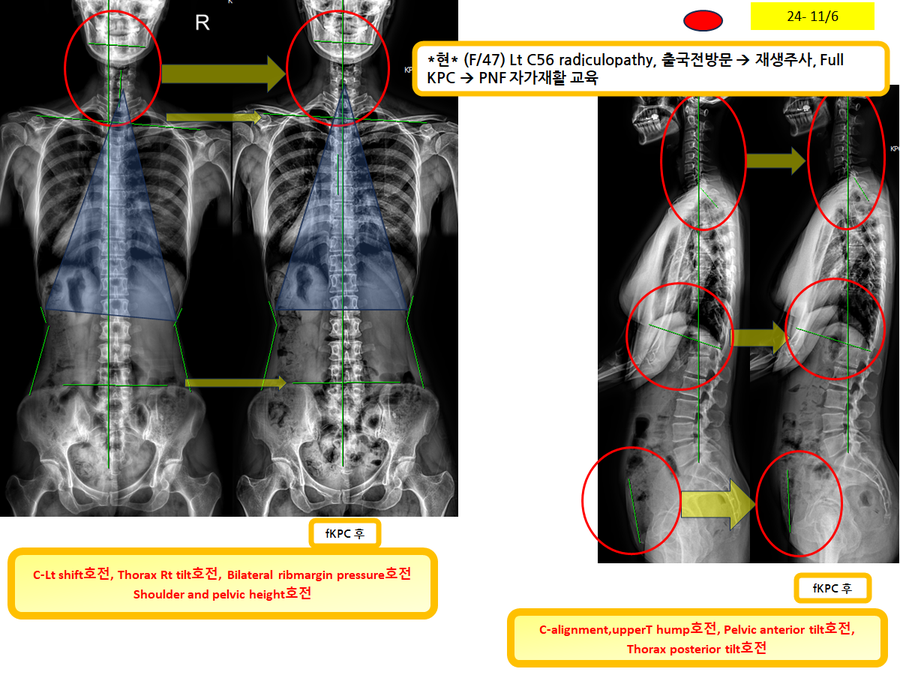 fc1aa50b627a46be9fb8144acf38848e_1730953498_8229.png