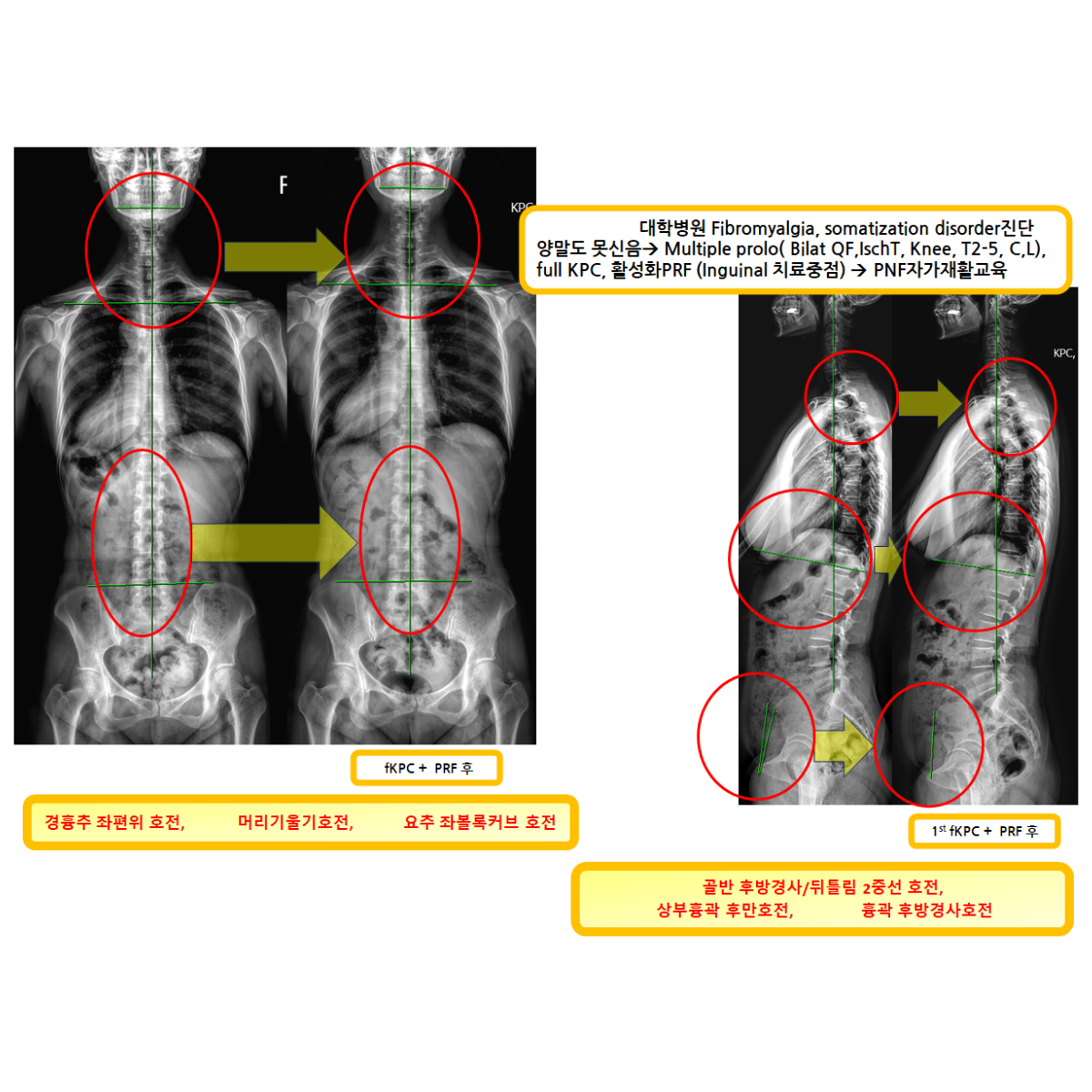 e8050efdfa68d78f7f763bf3a7dd7138_1788323329_9277.png e8050efdfa68d78f7f763bf3a7dd7138_1788323329_9277.png