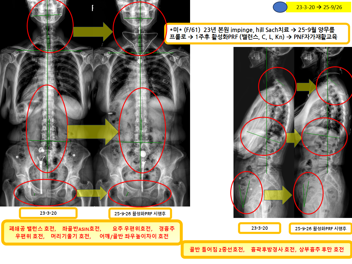 5a31014ebabd32316be87ea5b451e315_1761199318_794.png 5a31014ebabd32316be87ea5b451e315_1761199318_794.png