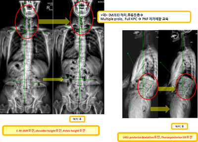 5d966edd90b41f21e0a98f777afa5842_1722900147_7762.png 5d966edd90b41f21e0a98f777afa5842_1722900147_7762.png