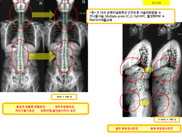 7fb5f5f59f9ca01e06e39672b61bd35e_1743126679_7704.png 7fb5f5f59f9ca01e06e39672b61bd35e_1743126679_7704.png