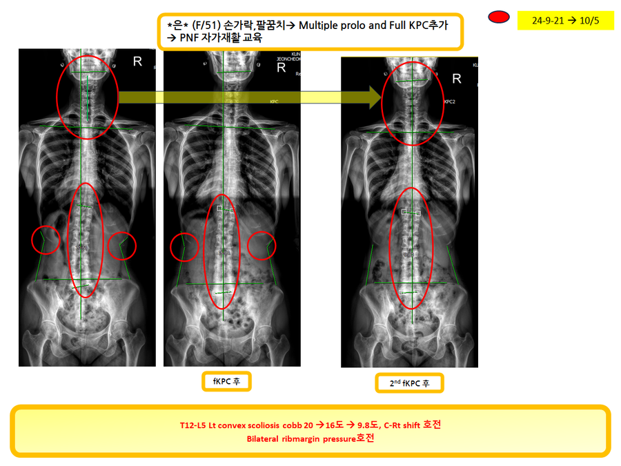 9c9b89fa237104965526dc6db5057a19_1728131322_2345.png 9c9b89fa237104965526dc6db5057a19_1728131322_2345.png