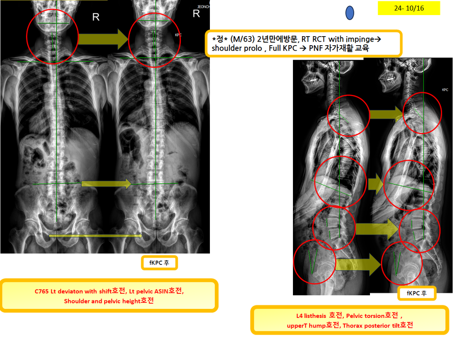 bdb7d69cd7e680d69e4cb18f68c7747e_1729172854_9262.png bdb7d69cd7e680d69e4cb18f68c7747e_1729172854_9262.png