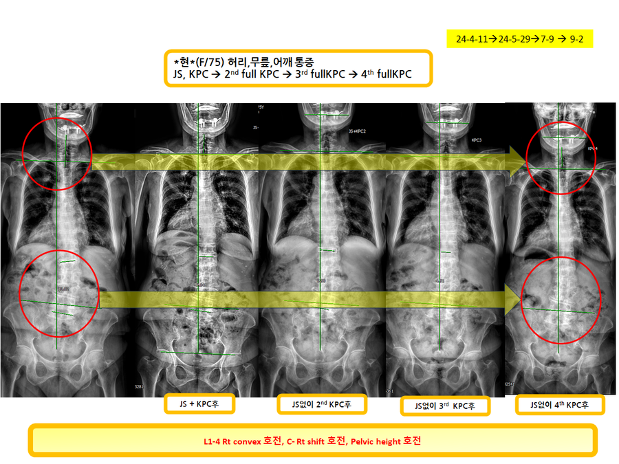 ebc715e9e420d8821fa8fa81553e4d7f_1725426390_4579.png ebc715e9e420d8821fa8fa81553e4d7f_1725426390_4579.png